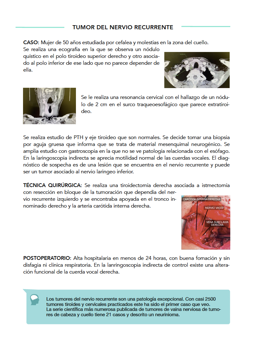 caso6 pdf